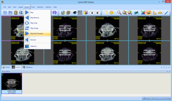 Sante MRI Viewer screenshot 10