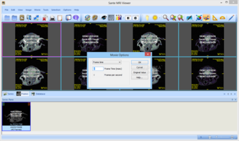 Sante MRI Viewer screenshot 11