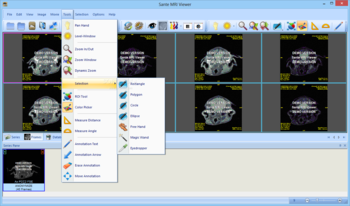 Sante MRI Viewer screenshot 12