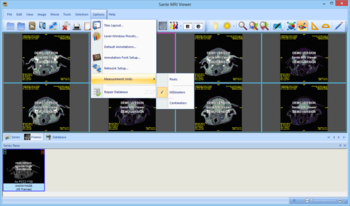 Sante MRI Viewer screenshot 14