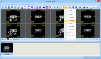 Sante MRI Viewer screenshot 2