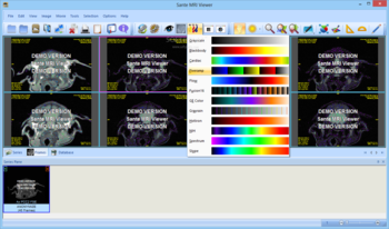 Sante MRI Viewer screenshot 3