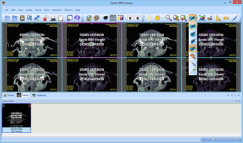 Sante MRI Viewer screenshot 4