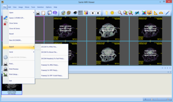 Sante MRI Viewer screenshot 6
