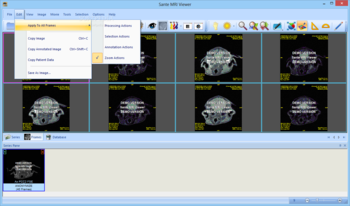 Sante MRI Viewer screenshot 7