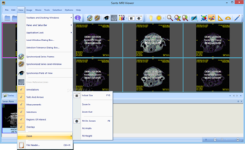 Sante MRI Viewer screenshot 8