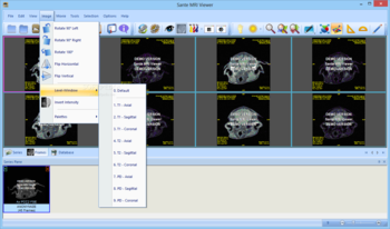 Sante MRI Viewer screenshot 9