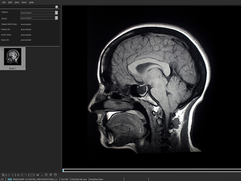 SeePlus DICOM screenshot