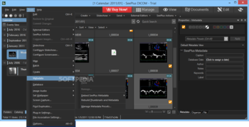 SeePlus DICOM screenshot 10