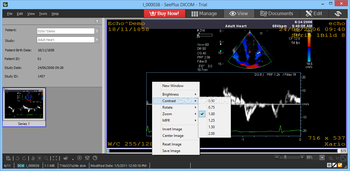 SeePlus DICOM screenshot 4