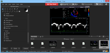 SeePlus DICOM screenshot 6