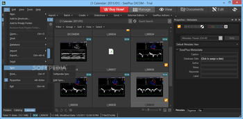 SeePlus DICOM screenshot 7