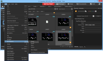 SeePlus DICOM screenshot 8