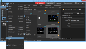 SeePlus DICOM screenshot 9