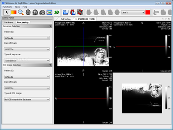 SepINRIA screenshot 2