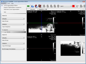 SepINRIA screenshot 3