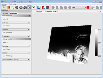 SepINRIA screenshot 4