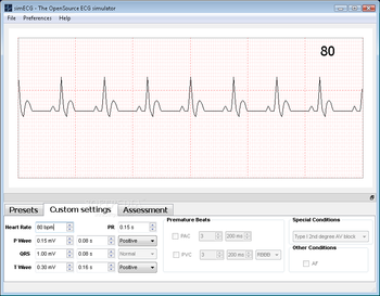 simECG screenshot