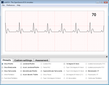 simECG screenshot 2