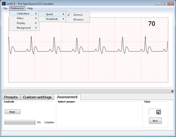simECG screenshot 3
