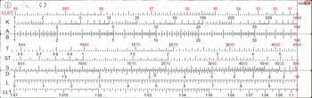 SLIDeRULe screenshot