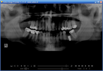 Sobox Image Preview screenshot