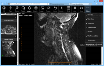 SonicDICOM Media Viewer screenshot 10