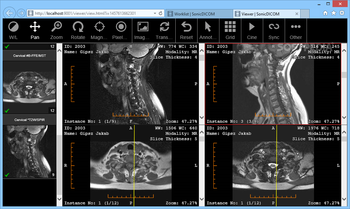 SonicDICOM Media Viewer screenshot 3