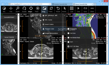 SonicDICOM Media Viewer screenshot 4