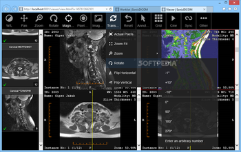 SonicDICOM Media Viewer screenshot 5