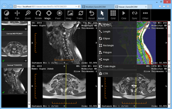 SonicDICOM Media Viewer screenshot 6