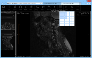 SonicDICOM Media Viewer screenshot 7