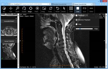 SonicDICOM Media Viewer screenshot 8