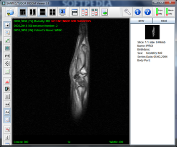 Tudor DICOM Viewer screenshot