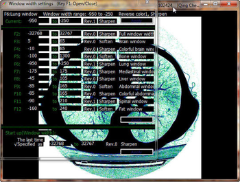 Urografin screenshot