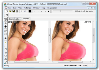 Virtual Plastic Surgery Software  screenshot