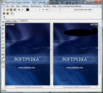 Virtual Plastic Surgery Software - VPSS screenshot