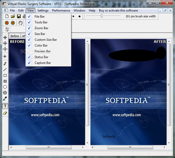Virtual Plastic Surgery Software - VPSS screenshot 4