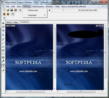Virtual Plastic Surgery Software - VPSS screenshot 5