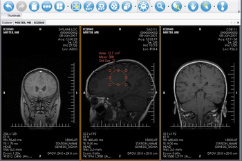 XRayline Workstation screenshot 10