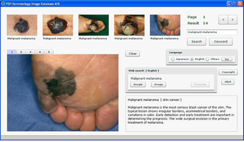 YSP Dermatology Image Database AIR screenshot
