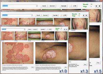 YSP Dermatology Image Database screenshot